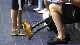 Artificial Limbs